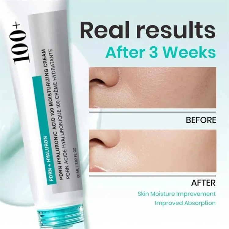 کرم مرطوب کننده Anua PDRN Hyaluronic Acid